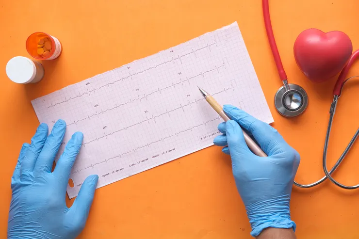 Imagem mostrando um eletrocardiograma em papel sendo analisado por uma pessoa usando luvas azuis. Ao lado, há um estetoscópio, um modelo de coração vermelho e um frasco de medicamentos, sugerindo um ambiente médico voltado para a avaliação de saúde cardiovascular.